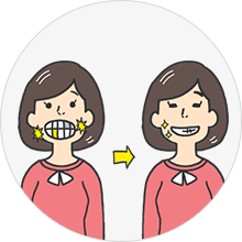 銀歯を目立たなくさせたい（イメージ）